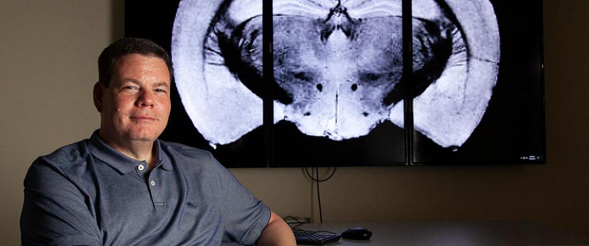 Dr. Sam Grant uses the imaging power of a 21 Tesla magnet to see inside the brain during migraine.